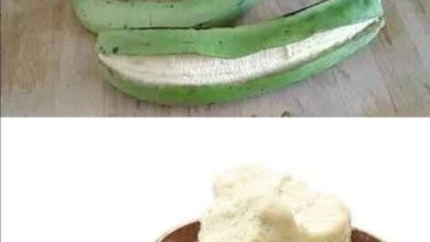 Photo of Stretch Mark Remedy